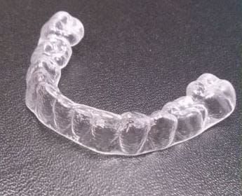 Cos’è l’ortodonzia invisibile?